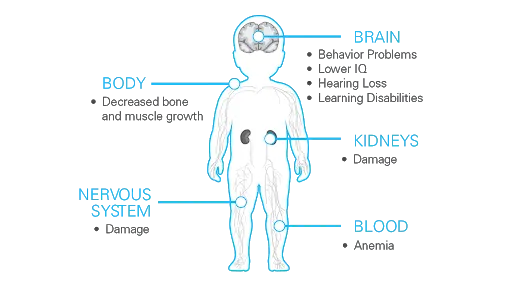 How Lead Affects Children